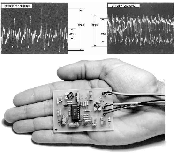 Save 30% speech processor kit blows their ears off 